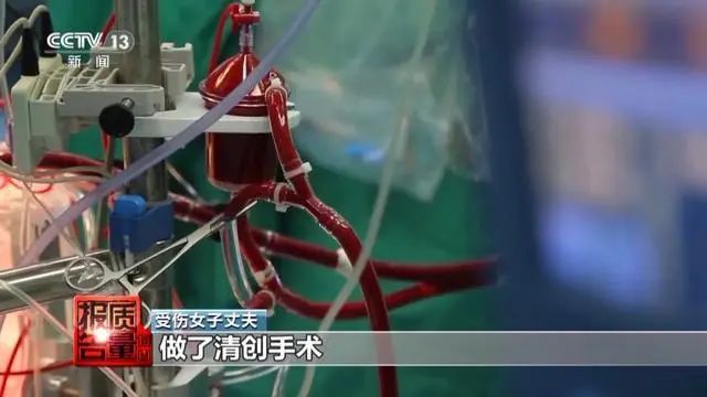 上海“4·4”自动人行道事故原因披露，央视专题报道：“电梯维保”如何保平安?-图片2