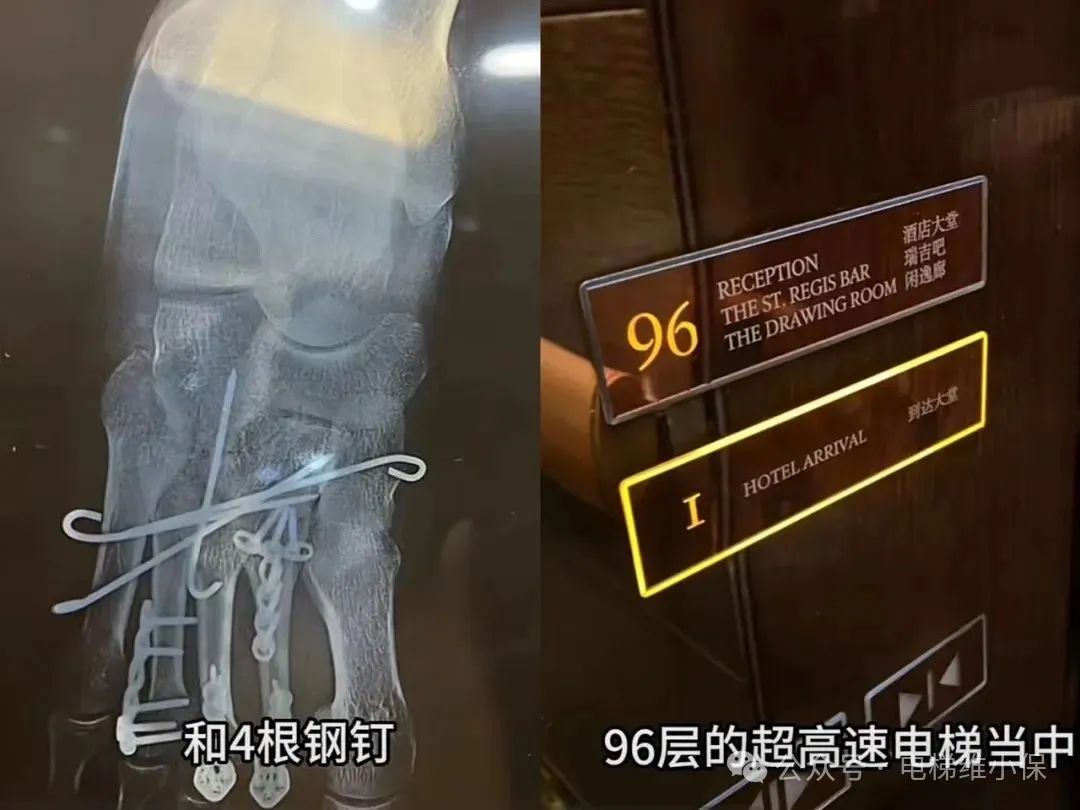 深圳一96层电梯坠梯致人受伤?酒店:非坠梯!上海三菱:无权奉告! 深圳一96层电梯坠梯致人受伤?酒店:非坠梯!上海三菱:无权奉告!