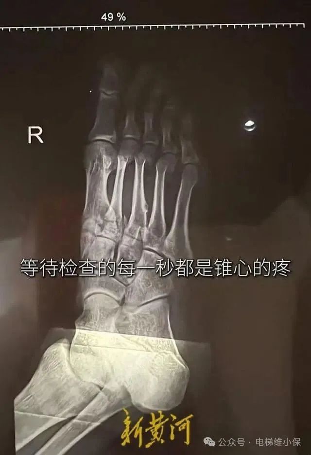 深圳一96层电梯坠梯致人受伤?酒店:非坠梯!上海三菱:无权奉告! 深圳一96层电梯坠梯致人受伤?酒店:非坠梯!上海三菱:无权奉告!